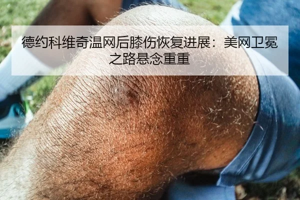 德约科维奇温网后膝伤恢复进展：美网卫冕之路悬念重重